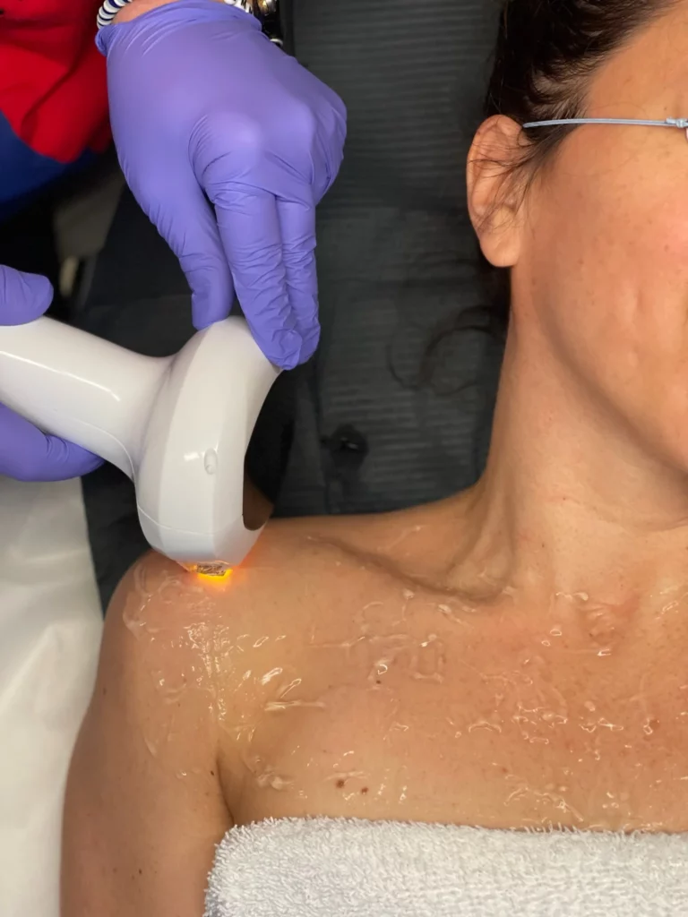 Skin Brightening | EMME Medical Spa | Orchard Park, NY