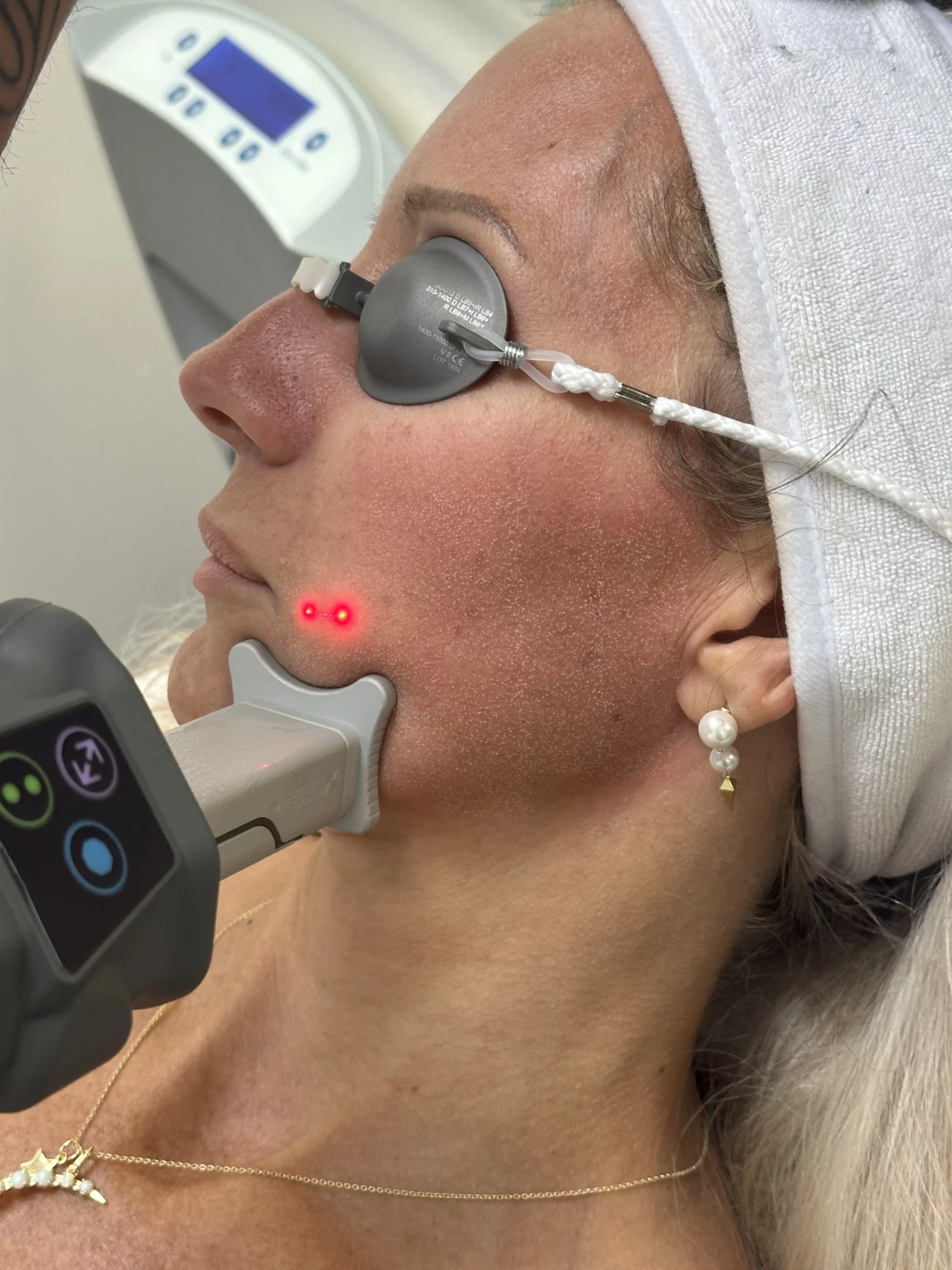 HELIX Laser | EMME Medical Spa | Orchard Park, NY